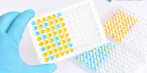 Định lượng protein dị ứng trong thực phẩm với xét nghiệm ELISA